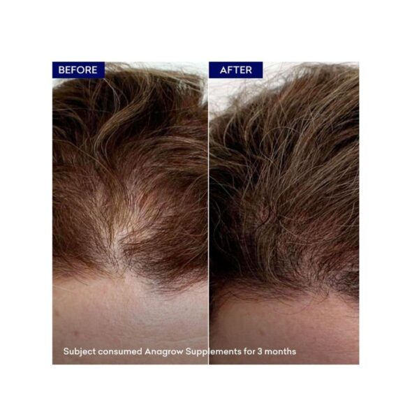 En Pharm Anagrow Biotin 10,000mcg with Keratin 30 Softgel Capsules Results
